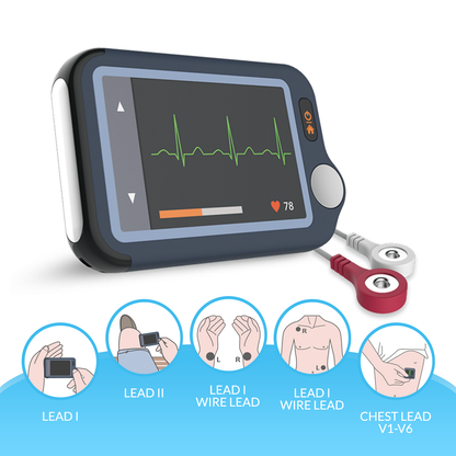 iCare® PB-20 Portable ECG Monitor (for iPhone & Android, Mac & Windows)Wireless EKG Monitoring Device