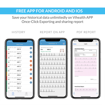 iCare® PB-20 Portable ECG Monitor (for iPhone & Android, Mac & Windows)Wireless EKG Monitoring Device
