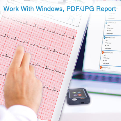 iCare® PB-20 Portable ECG Monitor (for iPhone & Android, Mac & Windows)Wireless EKG Monitoring Device
